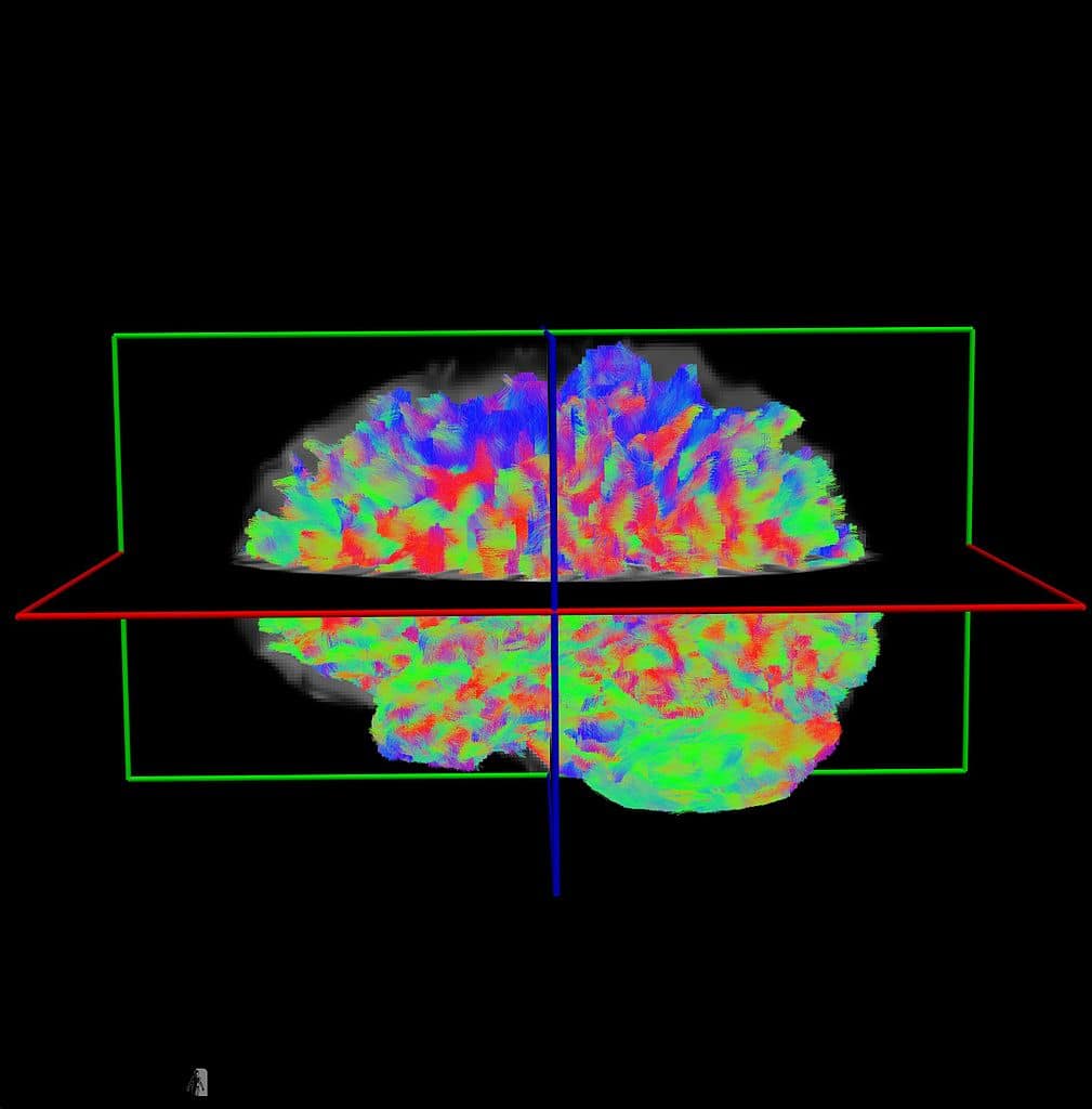 Utiliser la stimulation cérébrale transcrânienne pour conserver les capacités du cerveau chez les seniors